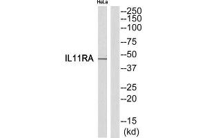 Western Blotting (WB) image for anti-Interleukin 11 Receptor, alpha (IL11RA) (C-Term) antibody (ABIN1852556) (IL11RA Antikörper  (C-Term))