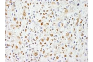 anti-Zinc Finger Protein 335 (ZNF335) (C-Term) antibody