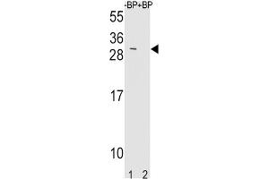 Western Blotting (WB) image for anti-TIMP Metallopeptidase Inhibitor 3 (TIMP3) antibody (ABIN3004040) (TIMP3 Antikörper)