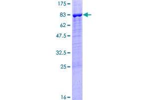 PPP2R5B Protein (AA 1-497) (GST tag)