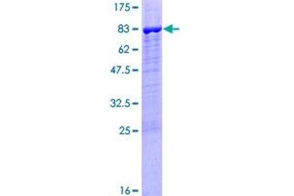 PPP2R5B Protein (AA 1-497) (GST tag)