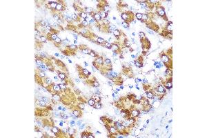 Immunohistochemistry of paraffin-embedded human liver using GATM Rabbit pAb (ABIN6133283, ABIN6140984, ABIN6140985 and ABIN6222282) at dilution of 1:100 (40x lens).