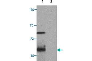 Western blot analysis of TYW1 in human lung tissue lysate with TYW1 polyclonal antibody  at 1 ug/mL. (TYW1 Antikörper  (C-Term))