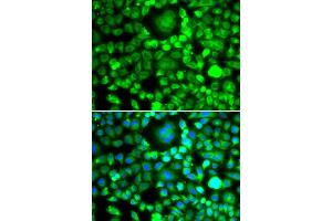 Immunofluorescence analysis of MCF-7 cells using BLID antibody (ABIN5974377). (BLID Antikörper)