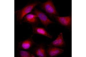 Immunofluorescence (IF) image for anti-B-Cell CLL/lymphoma 2 (BCL2) antibody (ABIN567617) (Bcl-2 Antikörper)