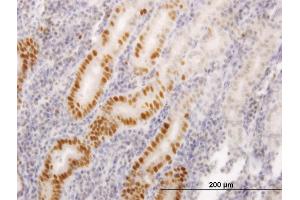 Immunoperoxidase of monoclonal antibody to LIG1 on formalin-fixed paraffin-embedded human stomach.