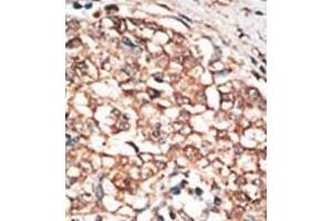 Image no. 2 for anti-Bone Morphogenetic Protein Receptor, Type IB (BMPR1B) (C-Term) antibody (ABIN357379) (BMPR1B Antikörper  (C-Term))