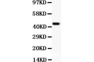 Western blot analysis of CD11b using anti-CD11b antibody (ABIN3043258). (CD11b Antikörper  (AA 17-382))