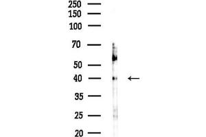 anti-PRP18 Pre-mRNA Processing Factor 18 (PRPF18) (Internal Region) antibody