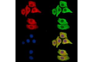 ABIN7096068 and ABIN7100130 staining Hela cells by IF/ICC. (CRISPLD2 Antikörper)