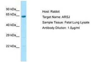 Image no. 1 for anti-Arylsulfatase J (ARSJ) (C-Term) antibody (ABIN6750084) (ARSJ Antikörper  (C-Term))