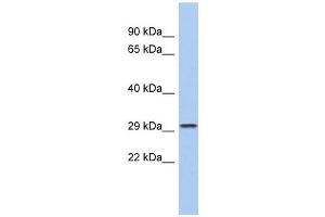CACNG6 antibody used at 1 ug/ml to detect target protein. (CACNG6 Antikörper  (N-Term))