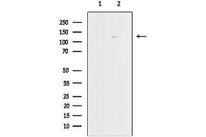 Western blot analysis of lysates from COLO320 cells, using p107 Antibody.