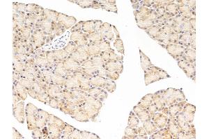 anti-Eukaryotic Translation Elongation Factor 1 epsilon 1 (EEF1E1) (N-Term) antibody
