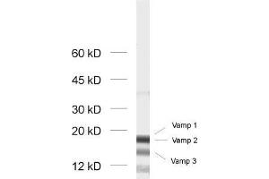 dilution: 1 : 1000, sample: rat brain homogenate (VAMP1, 2, 3 (AA 1-81) Antikörper)