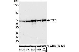 Western Blotting (WB) image for anti-Transcription Factor EB (TFEB) (AA 426-476) antibody (ABIN7453326)