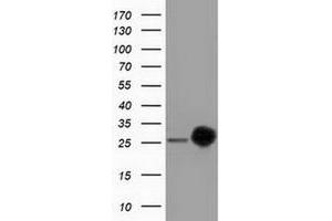 HEK293T cells were transfected with the pCMV6-ENTRY control (Left lane) or pCMV6-ENTRY CLPP (Right lane) cDNA for 48 hrs and lysed. (CLPP Antikörper)