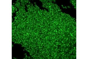 IF analysis of MCM2 using anti-MCM2 antibody (ABIN7601594). (MCM2 Antikörper  (AA 393-850))