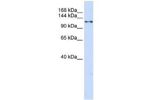 Western Blot showing XPO5 antibody used at a concentration of 1-2 ug/ml to detect its target protein.