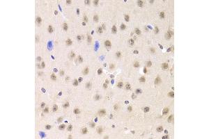 Immunohistochemistry of paraffin-embedded mouse brain using PRPF3 Antibody (ABIN1876670) at dilution of 1:100 (40x lens). (PRPF3 Antikörper)