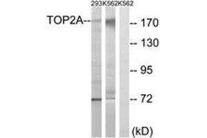 Western blot analysis of extracts from K562/293 cells, using TOP2A (Ab-1525) Antibody. (Topoisomerase II alpha Antikörper  (AA 1482-1531))