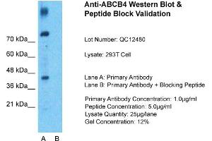 Host: Rabbit  Target Name: ABCB4  Sample Tissue: 293T Whole Cell  Lane A:  Primary Antibody Lane B: Primary Antibody + Blocking Peptide Primary Antibody Concentration: 1 µg/mL Peptide Concentration: 9 µg/mL Lysate Quantity: 941 µg/lane/LaneGel Concentration: 9. (ABCB4 Antikörper  (N-Term))