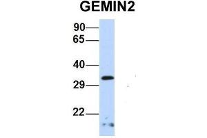 Host:  Rabbit  Target Name:  GEMIN2  Sample Type:  Human 721_B  Antibody Dilution:  1. (SIP1 Antikörper  (Middle Region))