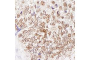 anti-Mismatch Repair Protein 2 (MSH2) (C-Term) antibody