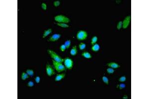 Immunofluorescent analysis of HepG2 cells using ABIN7142154 at dilution of 1:100 and Alexa Fluor 488-congugated AffiniPure Goat Anti-Rabbit IgG(H+L) (HRSP12 Antikörper  (AA 2-137))