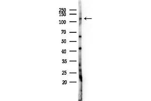 anti-PHD Finger Protein 15 (PHF15) antibody