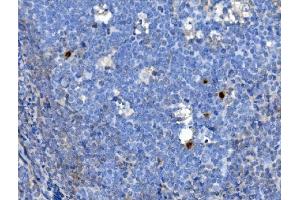 IHC analysis of JUNB using anti-JUNB antibody (ABIN7601187).