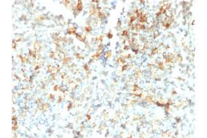 Immunohistochemistry (IHC) image for anti-neonatal Fc Receptor (FcRn) (AA 24-215) antibody (ABIN6939380)