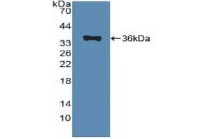Western Blotting (WB) image for anti-ATP-Binding Cassette, Sub-Family A (ABC1), Member 1 (ABCA1) (AA 1385-1663) antibody (ABIN7433309)