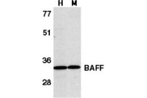 Image no. 2 for anti-Tumor Necrosis Factor (Ligand) Superfamily, Member 13b (TNFSF13B) (C-Term) antibody (ABIN204251) (BAFF Antikörper  (C-Term))