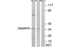 Western blot analysis of extracts from HeLa cells and HT-29 cells, using GIMAP5 antibody. (GIMAP5 Antikörper  (C-Term))
