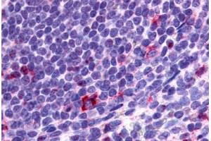 Anti-CCR2 antibody  ABIN1048390 IHC staining of human spleen, lymphocytes. (CCR2 Antikörper  (N-Term))