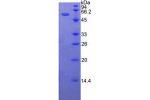 SDS-PAGE analysis of Human Intercellular Adhesion Molecule 5 Protein.