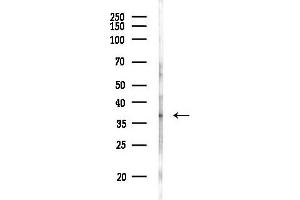 anti-Melanocortin 4 Receptor (MC4R) (C-Term) antibody
