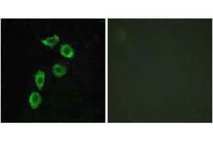 Immunofluorescence analysis of HuvEc cells, using GPR123 Antibody.