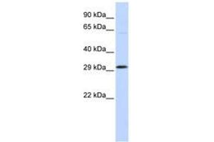 Image no. 1 for anti-Ovo-Like 2 (OVOL2) (C-Term) antibody (ABIN6740608) (OVOL2 Antikörper  (C-Term))