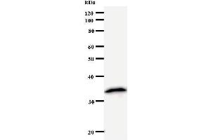 Western Blotting (WB) image for anti-Nudix (Nucleoside Diphosphate Linked Moiety X)-Type Motif 21 (NUDT21) antibody (ABIN933117) (NUDT21 Antikörper)