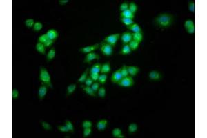Immunofluorescence staining of PC-3 cells with ABIN7163969 at 1:100, counter-stained with DAPI. (KCNC3 Antikörper  (AA 638-745))