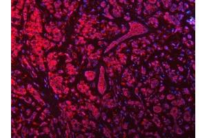 IF analysis of SEPTIN9 using anti-SEPTIN9 antibody (ABIN7600104). (Septin 9 Antikörper  (AA 15-282))