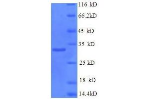 SDS-PAGE (SDS) image for Prohibitin (PHB) (AA 1-272), (full length) protein (His tag) (ABIN5710089)
