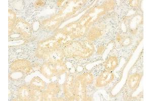 ABIN6264415 and ABIN6278511 at 1/100 staining human normal kidney tissue by IHC-P. (SLC26A5 Antikörper  (Internal Region))