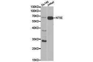 Western Blotting (WB) image for anti-5'-Nucleotidase, Ecto (CD73) (NT5E) antibody (ABIN1873965)