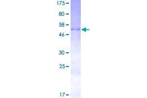 Image no. 1 for Oncostatin M (OSM) (AA 1-252) protein (GST tag) (ABIN1313717)