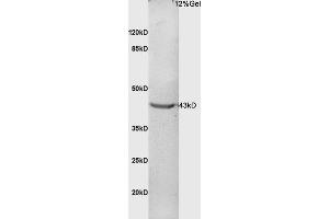 Mouse embryo lysates probed with Anti Phospho-CDK9 (Thr186) Polyclonal Antibody, Unconjugated (ABIN684088) at 1:200 in 4 °C. (CDK9 Antikörper  (pThr186))
