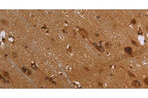 Immunohistochemistry of paraffin-embedded Human brain using FLNA Polyclonal Antibody at dilution of 1:40 (Filamin A Antikörper)