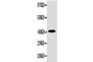 Anti-EDA antibody, Western blotting WB: SW620 Cell Lysate (Ectodysplasin A Antikörper  (Middle Region))
